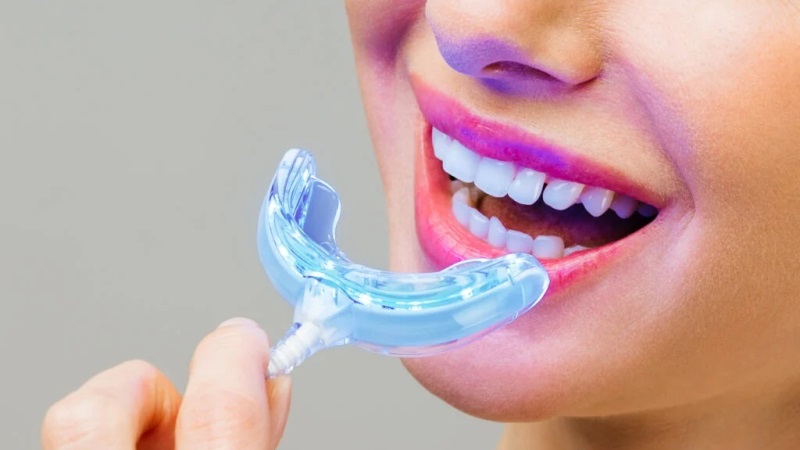 Navigating The Aisle Of Confusion To Whiten Your Teeth