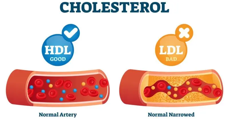 Understanding the Role of Cholesterol: HDL vs. LDL